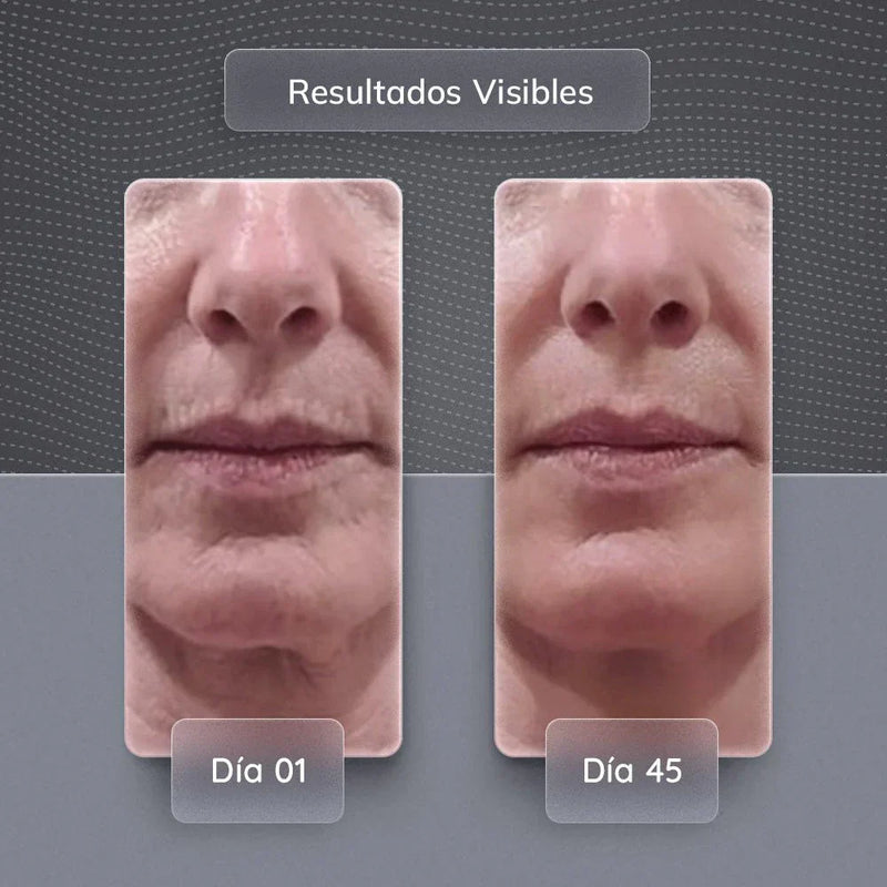 Skindion - Rejuvenecimiento Facial y Antiarrugas