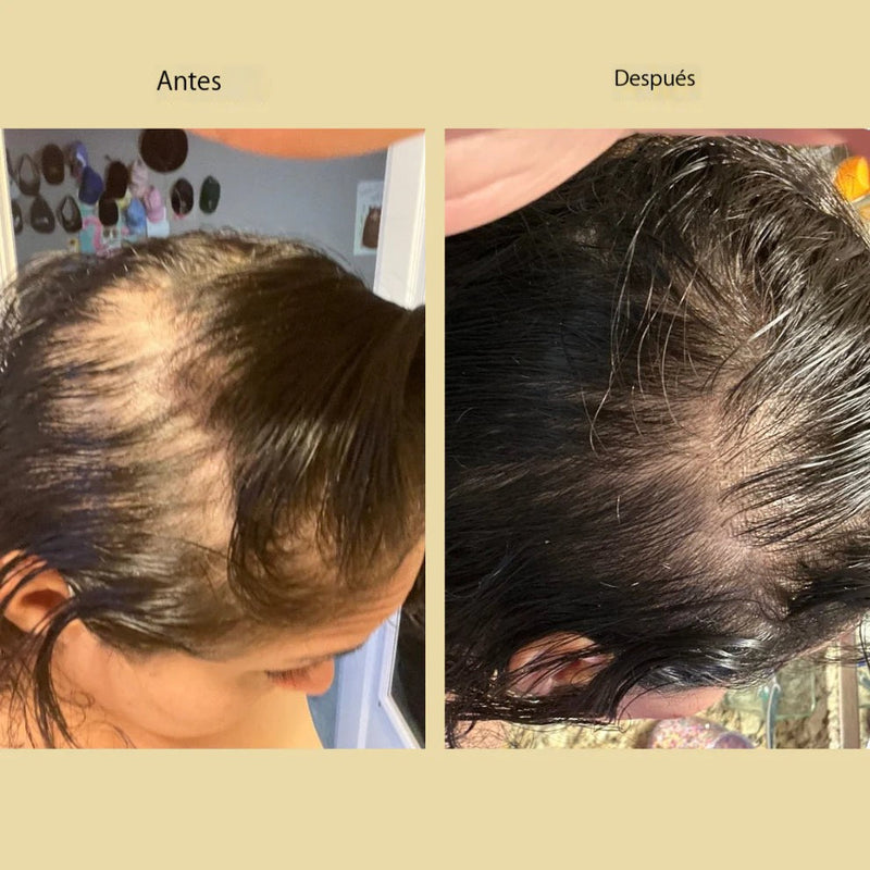 Aceite Vegano Natural para el Crecimiento del Cabello - COMPRA 1 OBTÉN 2